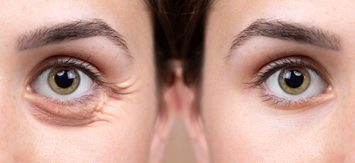 Before and after eyelid reconstruction images