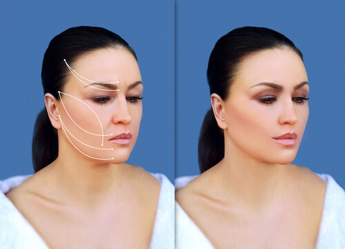 Before and after face threading images